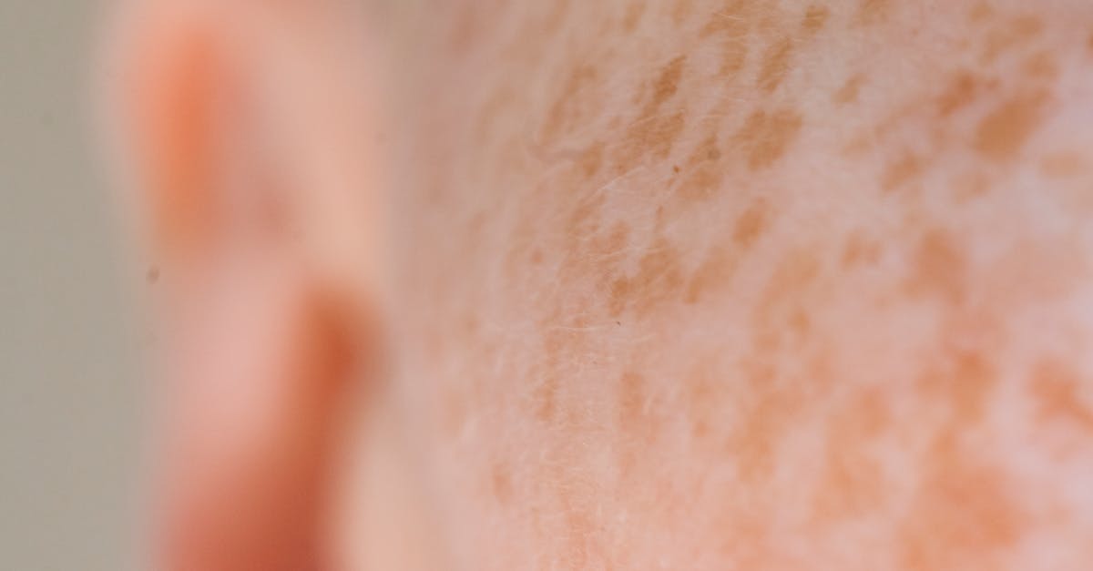 Roundup of the Most Effective Ear Wax Removal Techniques